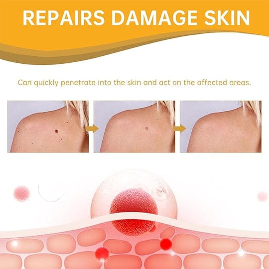 Tag Recede Eliminador de verrugas